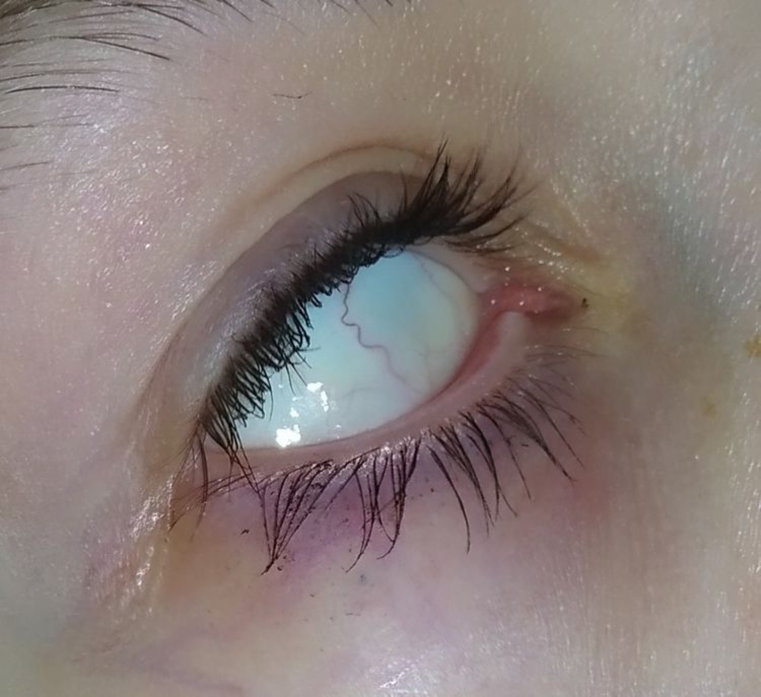 Extreme close-up of a human eye rolled back, whites fully showing