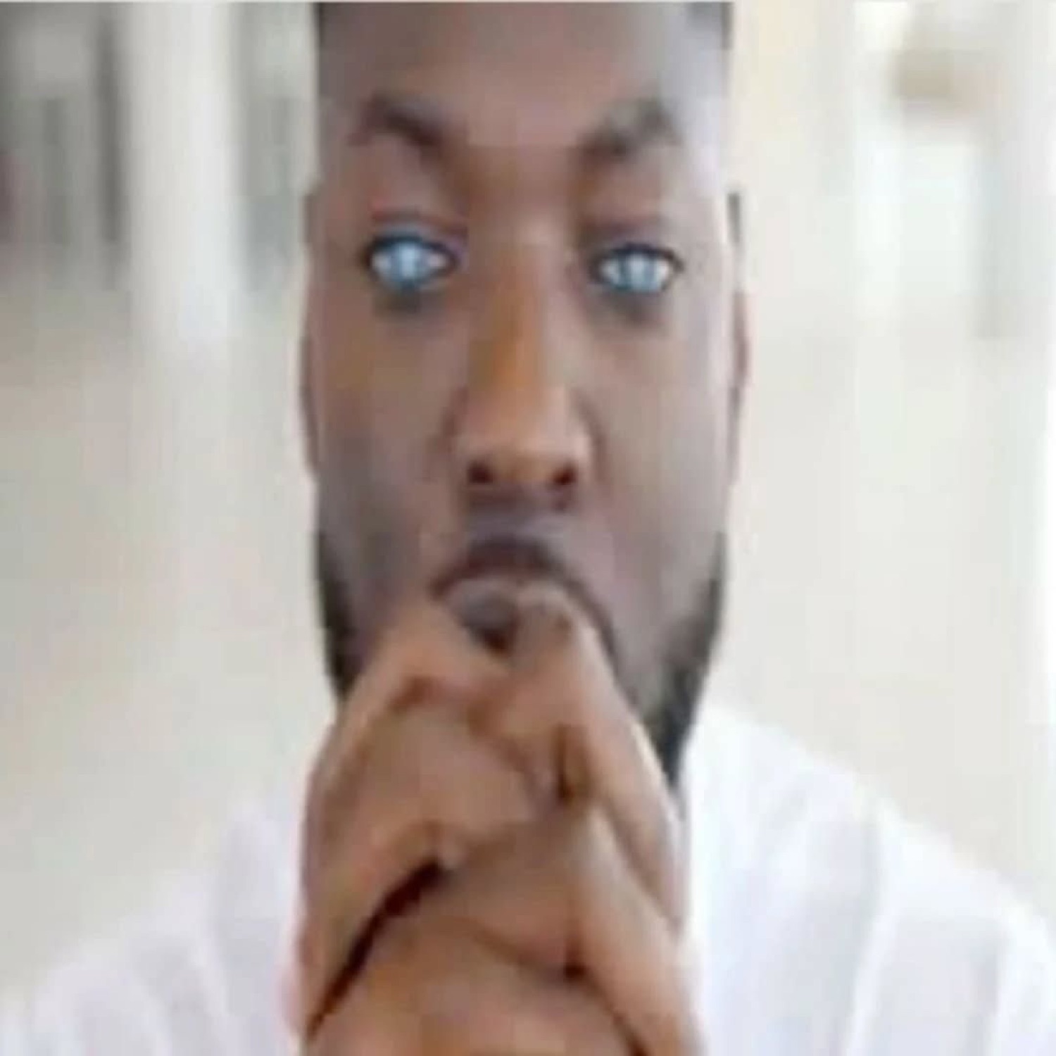 Man with edited all-white irises staring forward intensely with hands clasped under his chin