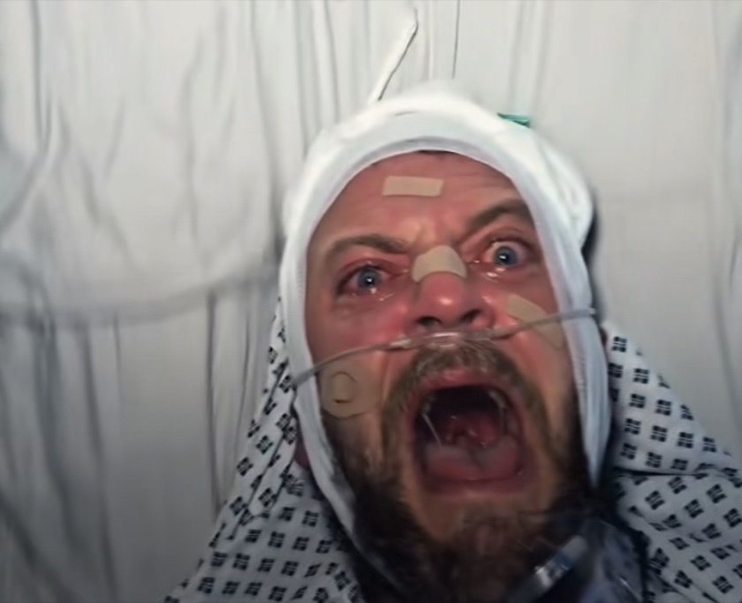 Man in a hospital gown with bandaged head screaming intensely into the camera