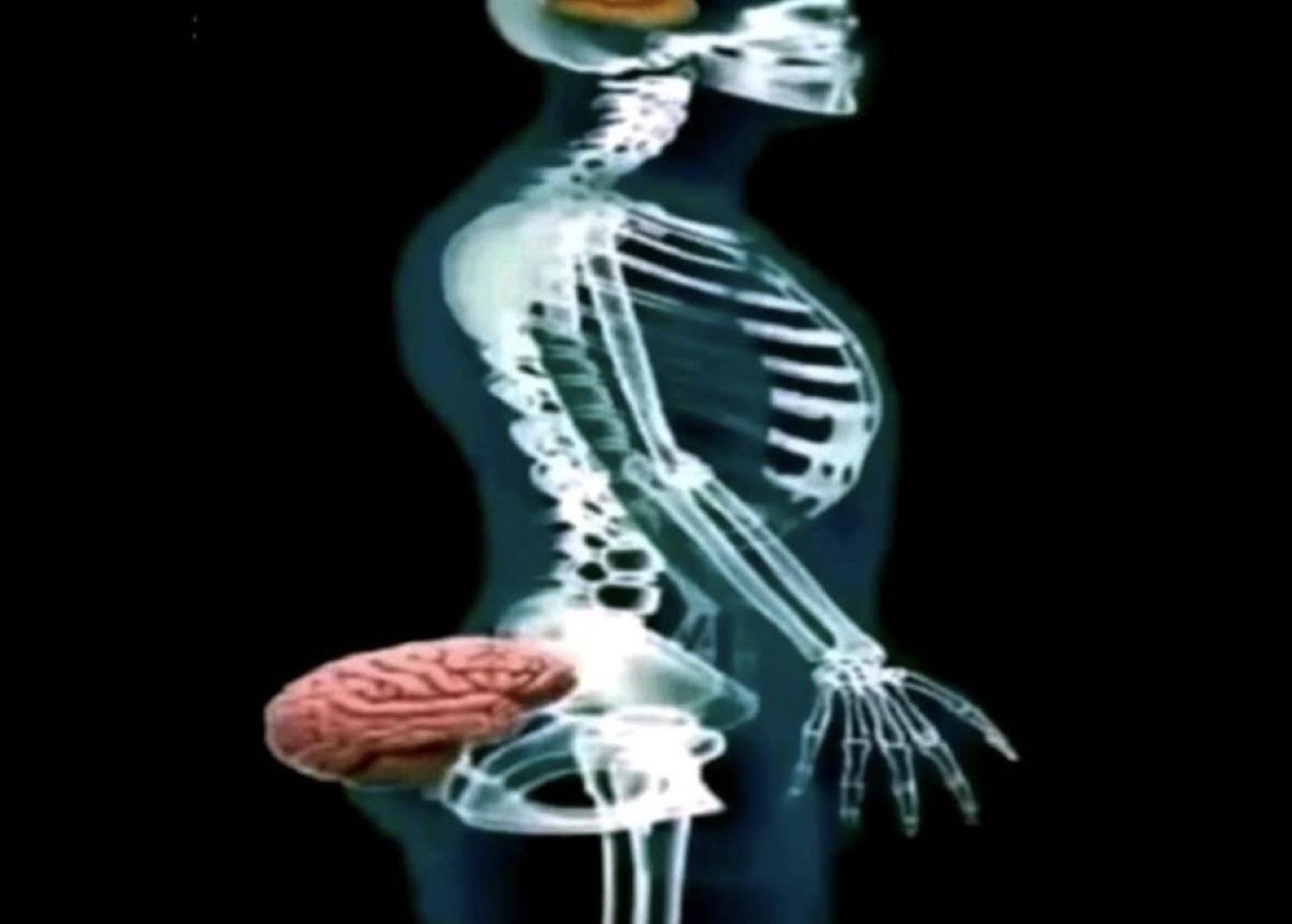 X-ray diagram of a body with the brain relocated to the butt
