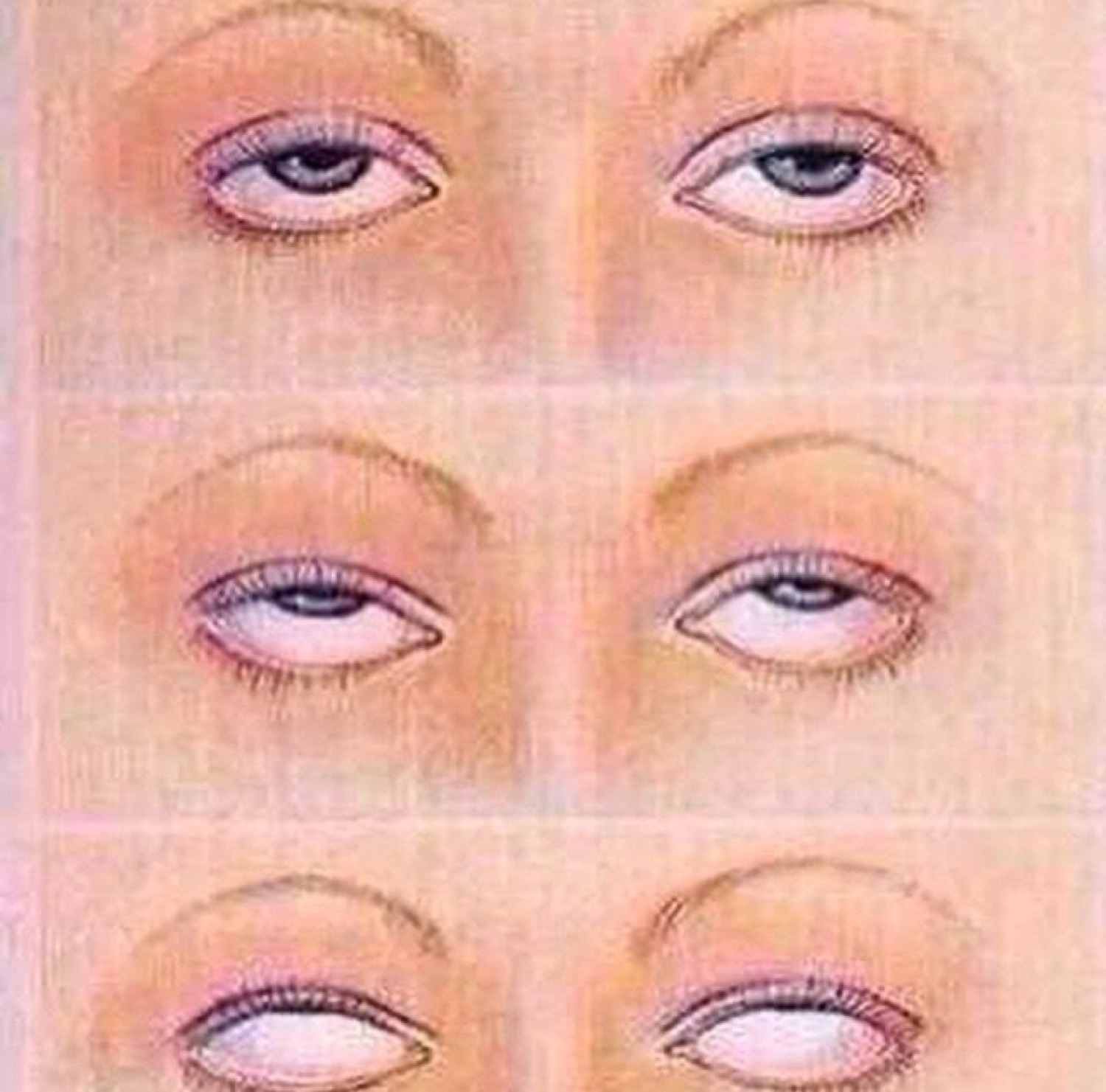 Illustrated diagram of a pair of eyes rolling further and further back
