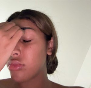 Young woman pressing her hand over her eyes in total exasperation