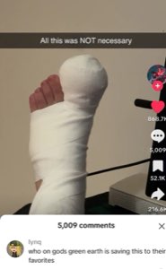 Heavily bandaged foot on TikTok captioned 'All this was NOT necessary' with 5K comments asking why anyone saved this