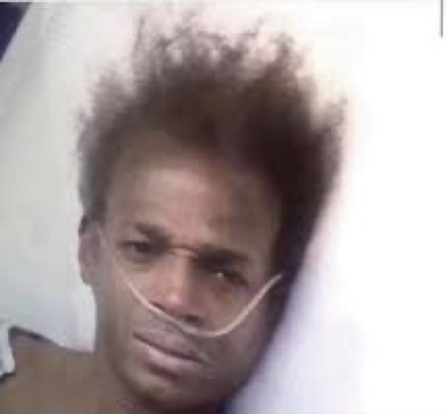 Man with wild hair and a nasal cannula lying in a hospital bed looking utterly drained