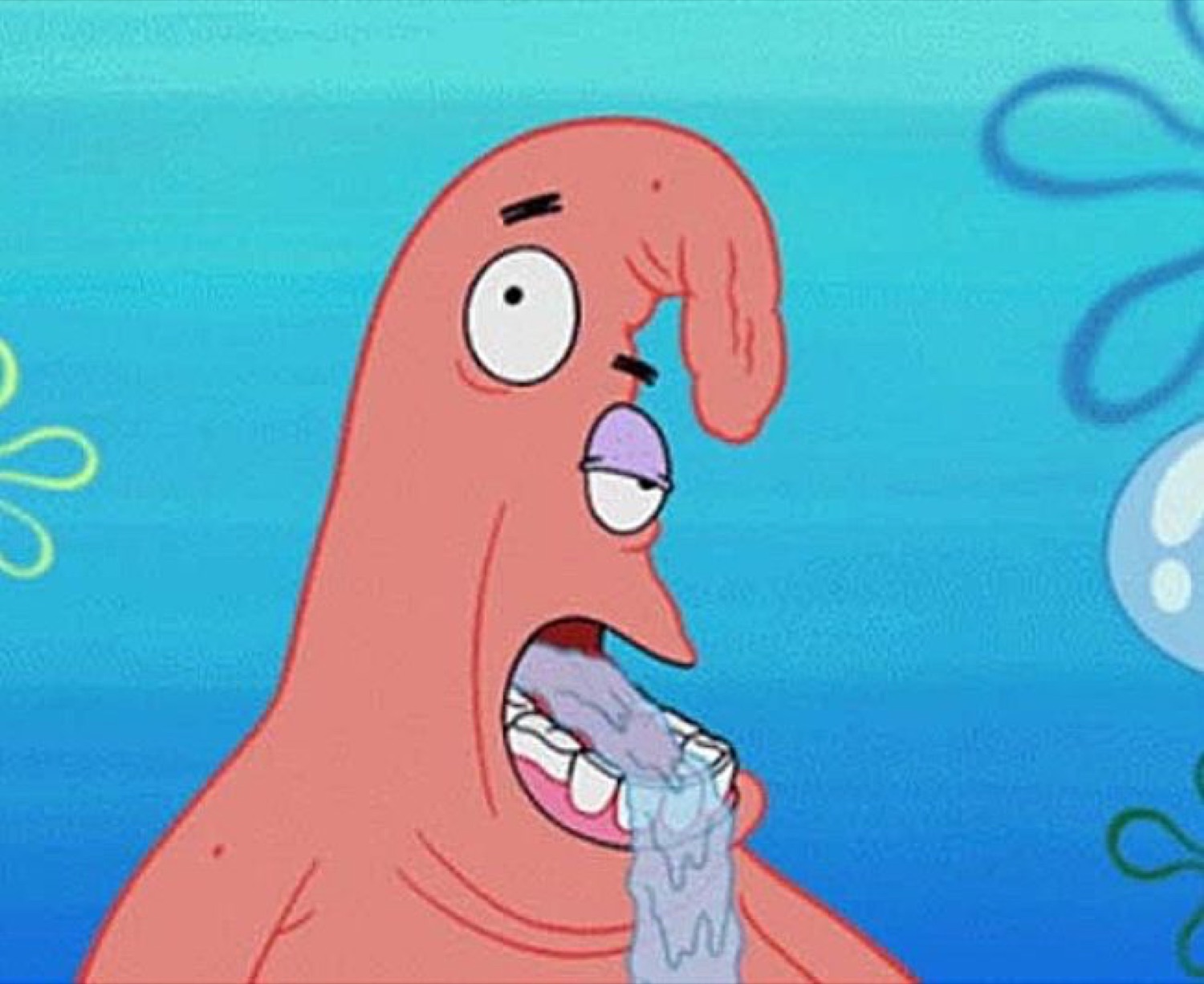 Patrick Star with a bewildered look, mouth open and drooling