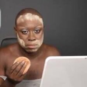 Man with a peeling face mask staring blankly at a laptop, completely over it