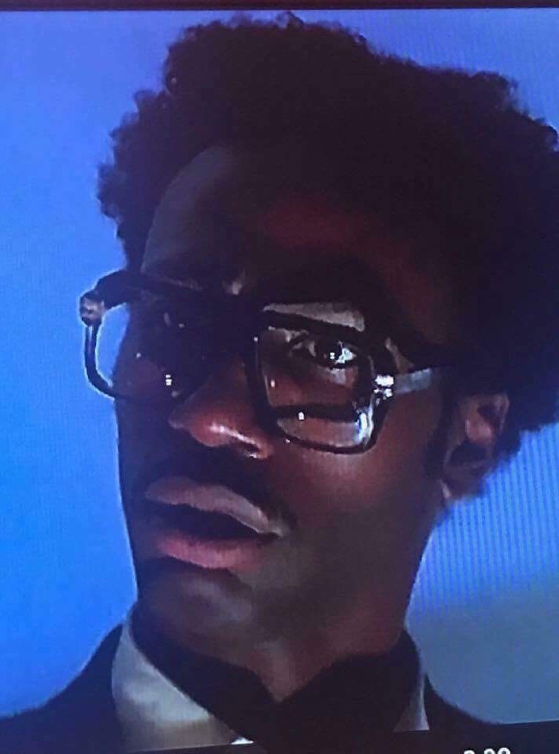 Man in thick glasses staring blankly, completely unimpressed