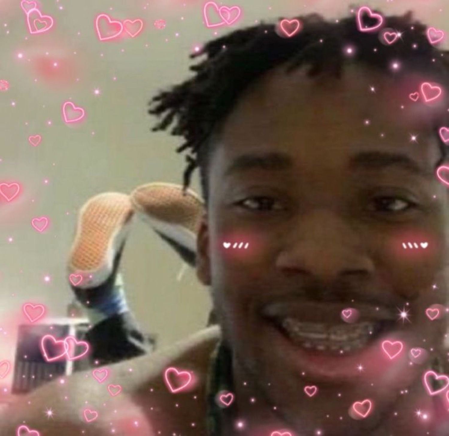 Guy with braces beaming through a pink hearts-and-blush filter