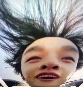 Upside-down selfie of a guy with hair hanging down and red, watery eyes