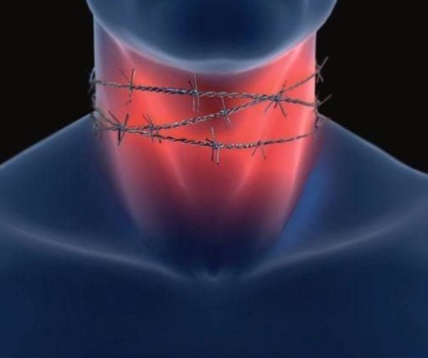 3D render of a human throat wrapped in barbed wire, glowing red from inside