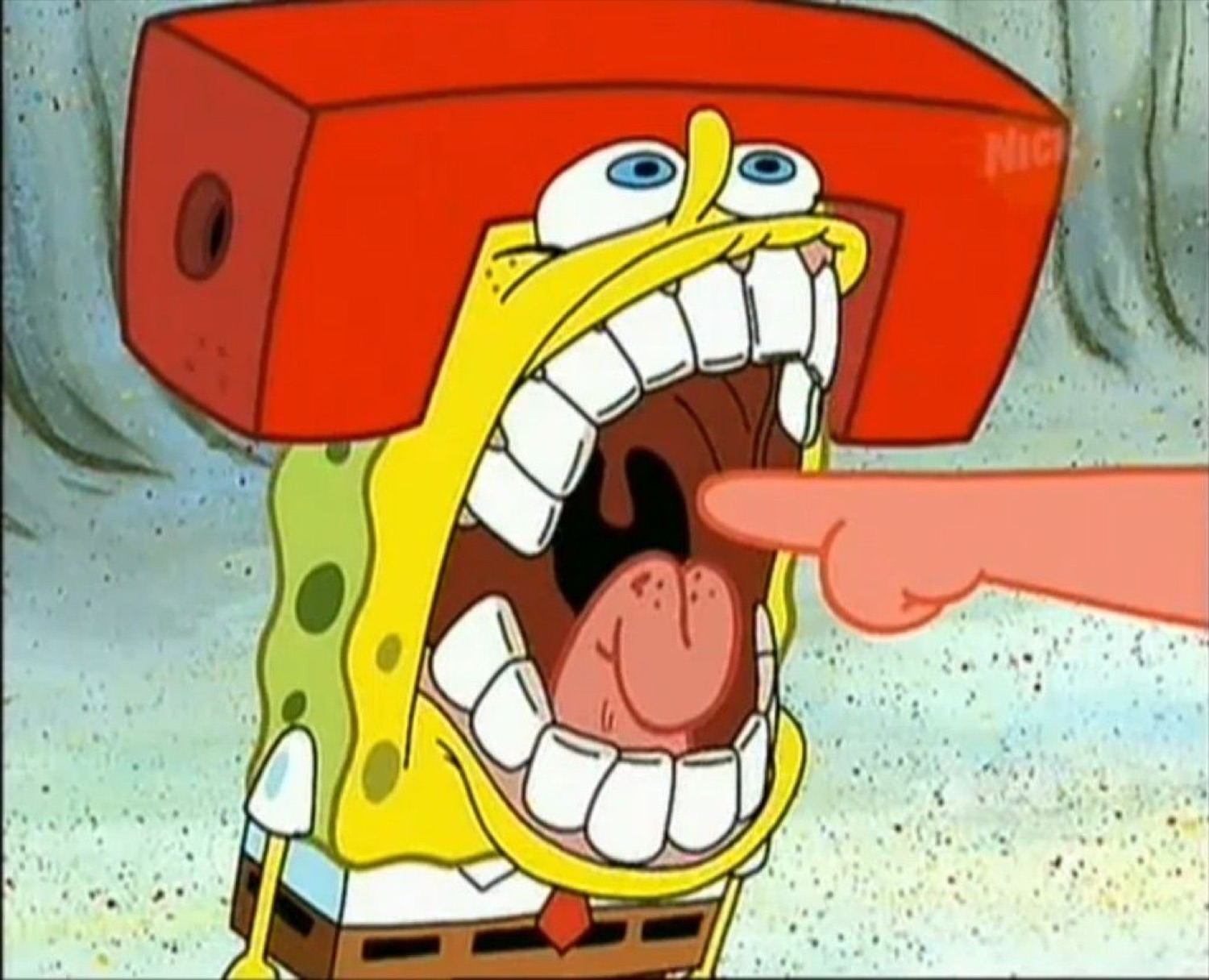 SpongeBob screaming with his mouth wide as a finger points down his throat
