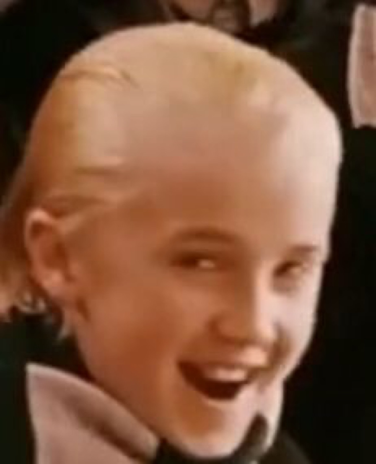 Young Draco Malfoy laughing with his mouth wide open