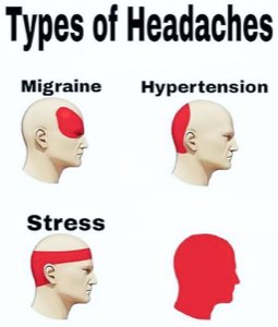Types of Headaches chart with a final all-red head left ominously unlabeled