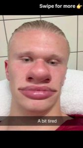 Erling Haaland selfie captioned 'A bit tired' with a completely deadpan face