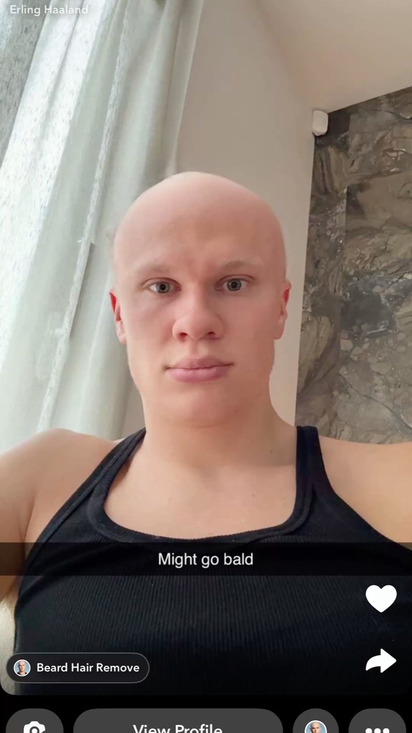 Erling Haaland selfie edited fully bald, captioned 'Might go bald' with a deadpan stare