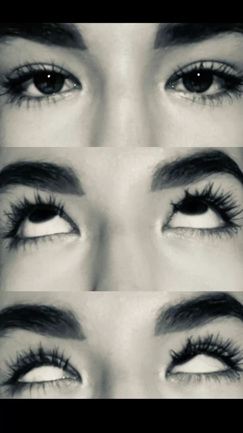Black-and-white triptych of a woman's eyes rolling all the way up and to the side