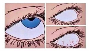Anime-style three-panel comic showing an eye going from normal to blank-white to bloodshot with crying