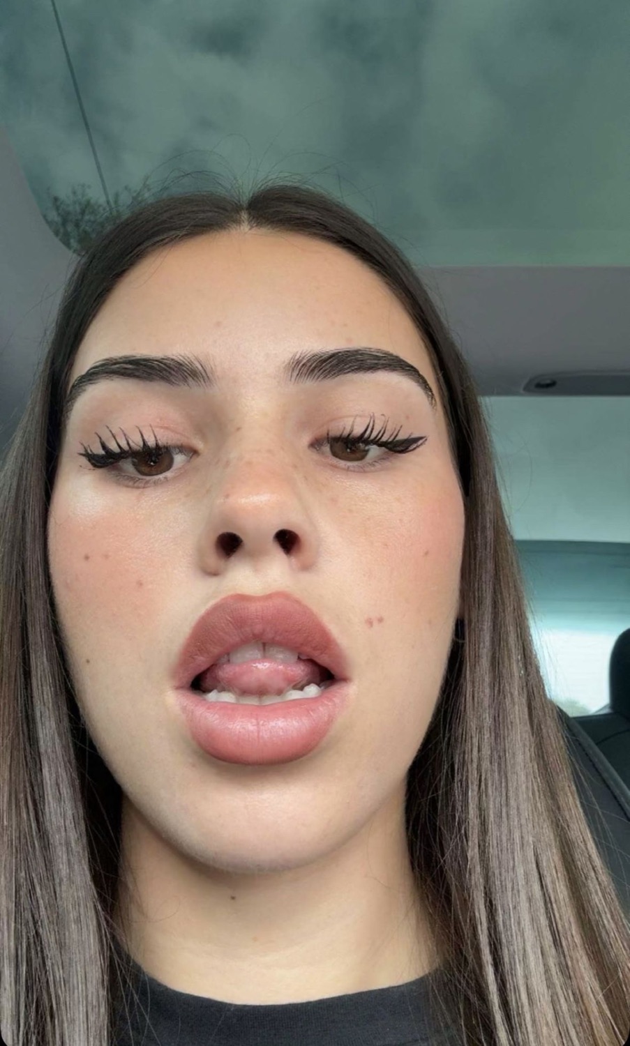Young woman staring blankly into the camera with her mouth slightly open