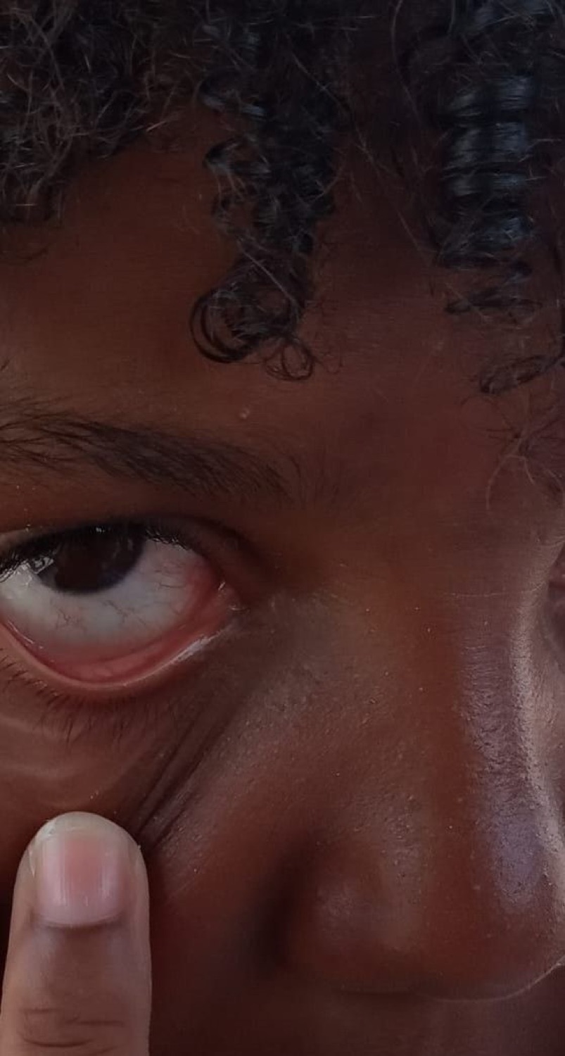 Extreme close-up of someone giving a flat, done side-eye with a finger by their cheek