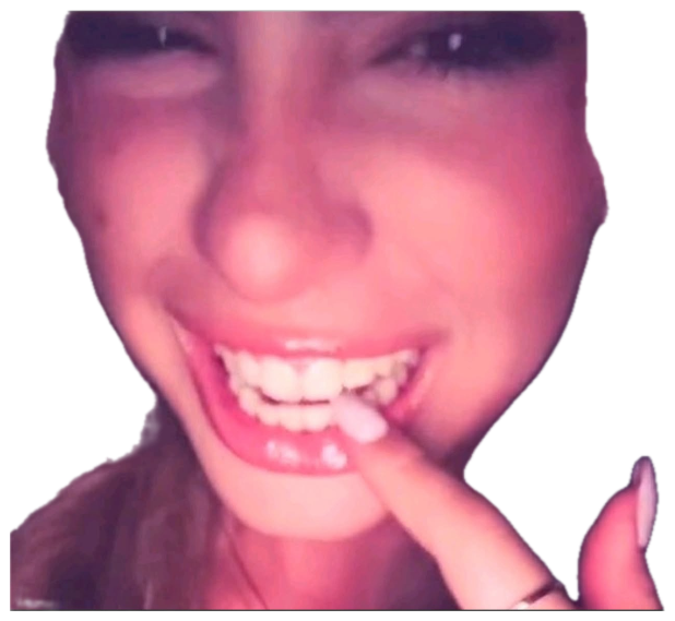 Woman pointing a finger at her teeth while grinning wide in a blurry close-up sticker